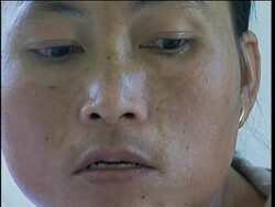 Babies and mothers with HIV treated at former US army base Instructional Video