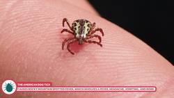 Ticks! They Can Really Make you Sick Instructional Video