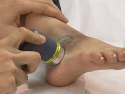Close up of injured womans leg Stock Footage