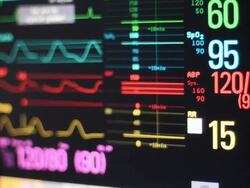 Vital signs monitor Stock Footage