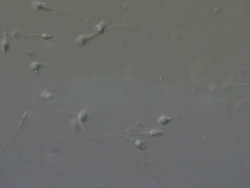 Human sperm swimming, Interference contrast Stock Footage