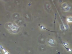 Single Human sperm swimming, Phase contrast Stock Footage