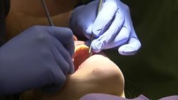 Dentist Checking Patients Teeth Stock Shots News Clip