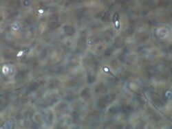 Human sperm swimming, Phase contrast Stock Footage