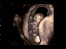 Young foetus moving in the womb, 4D ultrasound scan.. Stock Footage