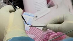 Lab mice helping cancer patients to tackle tumours News Clip