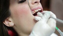 Mending patient's teeth Stock Footage