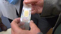 Viewer's choice: New 'smart bandages' for burn victims and others Instructional Video