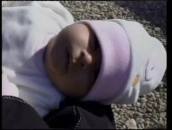 Iraqi baby with spina bifida to travel to US for treatment News Clip
