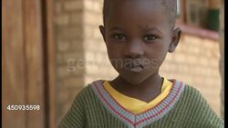 Young Boy With Missing Leg News Clip