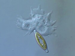 ECU T/L Shot of Amoeba is unicellular organism with constantly changing shape with moving forwards by sending out pseudopods which help it to crawl along surface and Diatoms are also moving / Newcastle Emlyn, Ceredigion, United Kingdom Stock Footage