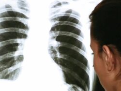 HD: Doctor Examining an x-ray image Stock Footage