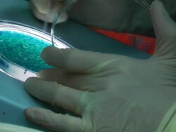 Blue bacteriophage plaques Stock Footage