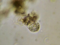 microbe Stock Footage