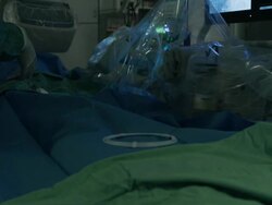 Vascular surgery. Stock Footage