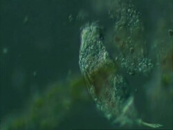 Rotifer nomarski in sensitive grey Stock Footage