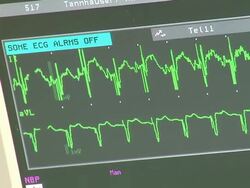 Heart Monitor Stock Footage