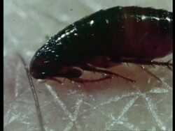 Cat flea feeding on human skin, archive, CU Stock Footage