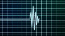 The screen of a heart monitor displays a single heartbeat. Stock Footage
