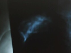 X-ray film Stock Footage