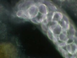 Ciliate unidentified Stock Footage