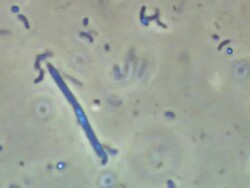 Human tongue bacteria from Human tongue scrape. Recorded using Phase Contrast illumination, horizontal field of view 50 micrometres. Stock Footage