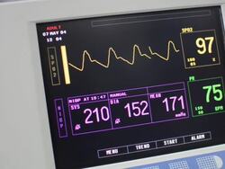Vital signs monitor Stock Footage
