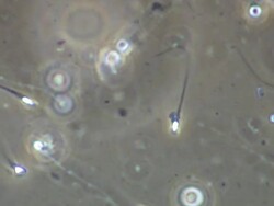 Single Human sperm swimming, Phase contrast Stock Footage