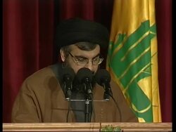 Surgeons perform rare surgery on baby with second head News Clip