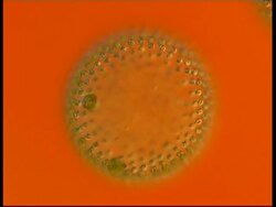 Microscopic view of Volvox, pull focus, orange background Stock Footage