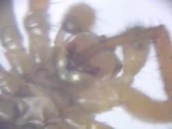 Spider under microscope Stock Footage