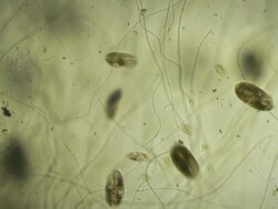 Microbes Stock Footage