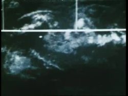 Grid lines move down a satellite weather map. News Clip