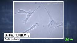 Why Do Heart Cells Turn into Bone? Instructional Video