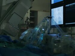 Vascular surgery. Stock Footage