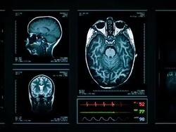 Brain MRI Scan. Top, front and lateral view. Blue. Stock Footage