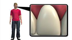 Shark teeth contain natural 'toothpaste' Instructional Video