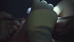 CLEAN: Women decide to remove their PIP breast implants News Clip