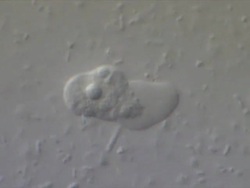 T/L cinemicrography of Amoeba sp motion at 1 frame per second viewed using a 40x S-Plan objective and Differential Interference Contrast. The wild sample was collected from a farm effluent drainpipe. Stock Footage