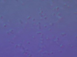 Bacteria: Escherischia coli K12 strain Stock Footage