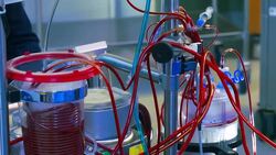 Surgery. Cardiopulmonary bypass machine Stock Footage