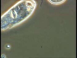 Paramecium and Spirochaeta bacteria moving around algal cell Stock Footage