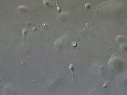 Human sperm swimming, race, Interference contrast Stock Footage