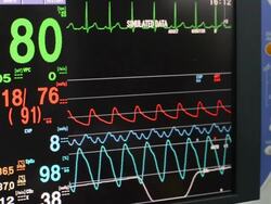 ECtorG monitor Stock Footage