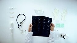 Medical staff examine x-ray in overhead angle Stock Footage