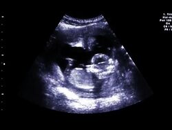 Ultrasound Stock Footage