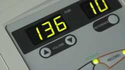 CTG exam of the pregnant woman Stock Footage