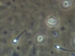 Single Human sperm swimming, close up, Phase contrast Stock Footage