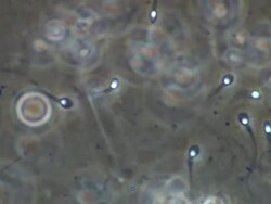 Human sperm swimming through shot Stock Footage