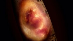 A dinosaur embryo develops inside an egg in a computer generated animation. Stock Footage